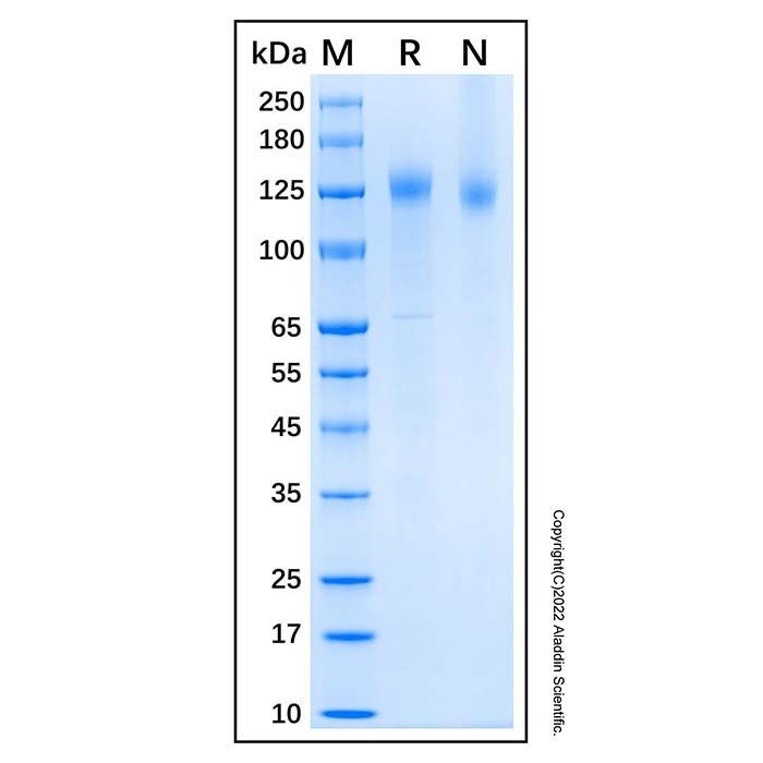 Recombinant Human CDO Protein -    by Aladdin Scientific