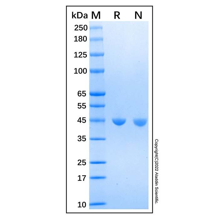 Recombinant Human Adenosylhomocysteinease/AHCY Protein -    by Aladdin Scientific