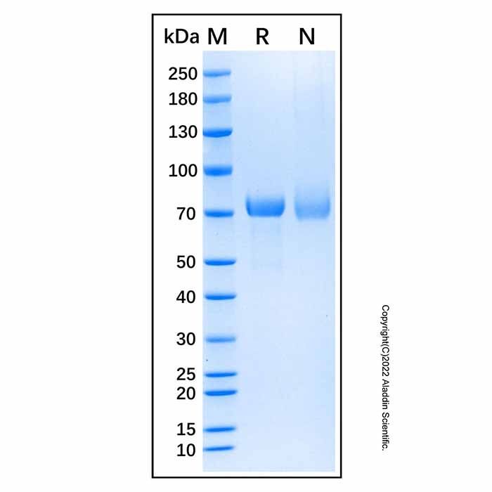 Recombinant Human Desmocollin-3 Protein -    by Aladdin Scientific