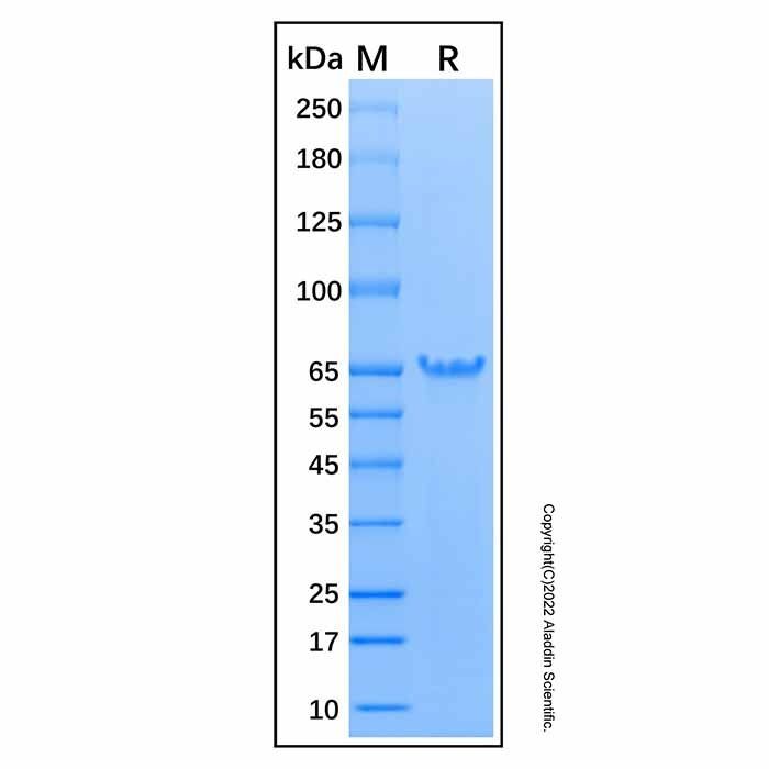Recombinant Human Exosome Component 9 Protein -    by Aladdin Scientific