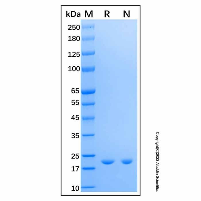Recombinant Human GPx-7 Protein -    by Aladdin Scientific