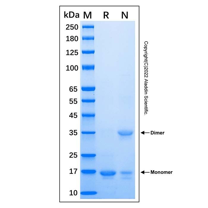 Recombinant Human CPLX1 Protein -    by Aladdin Scientific