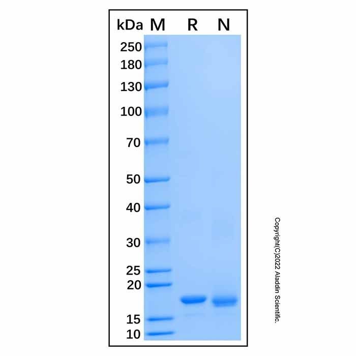 Recombinant Human DTD2 Protein -    by Aladdin Scientific