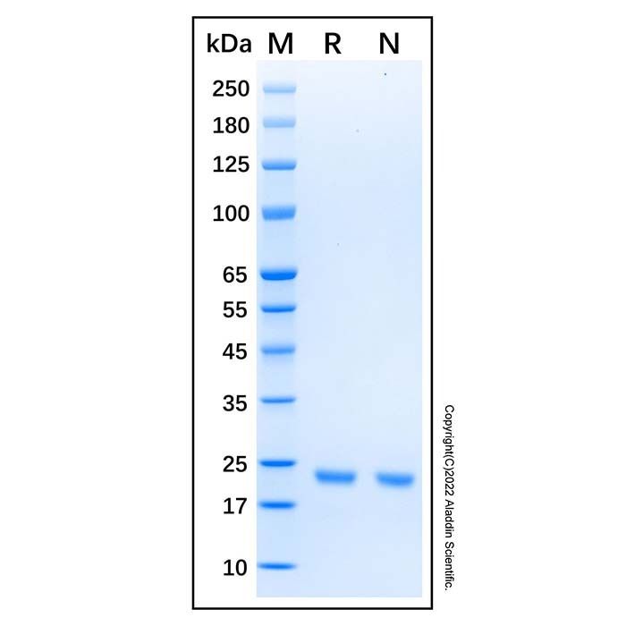 Recombinant Human KRAS (G12R) Protein -    by Aladdin Scientific