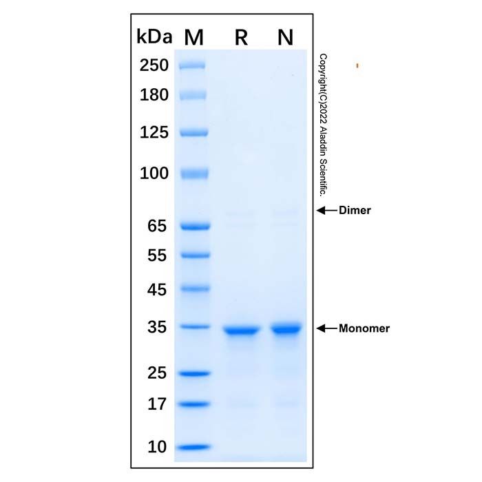 Recombinant Human EEF1D Protein -    by Aladdin Scientific