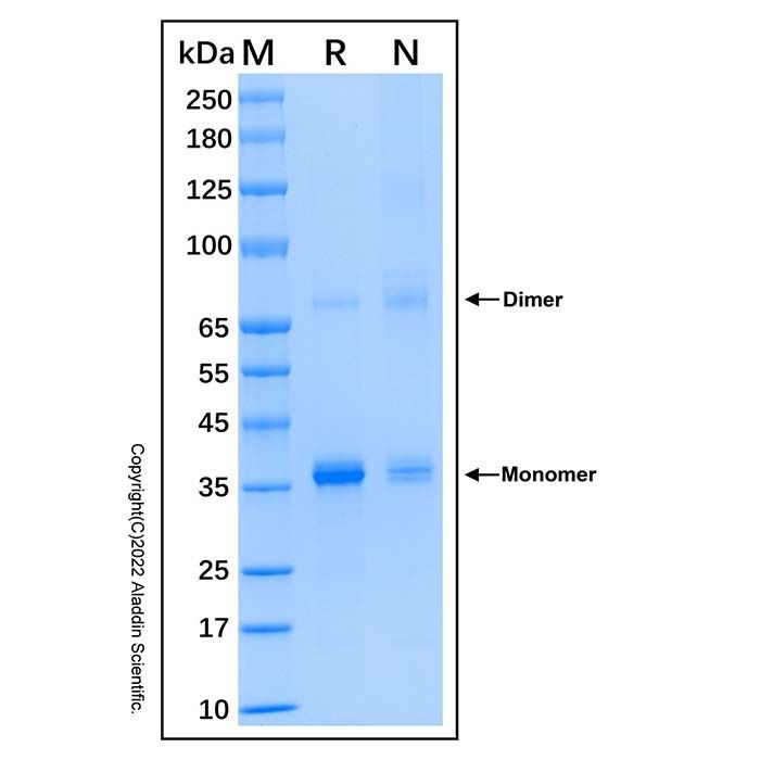 Recombinant Human GIMAP6 Protein -    by Aladdin Scientific