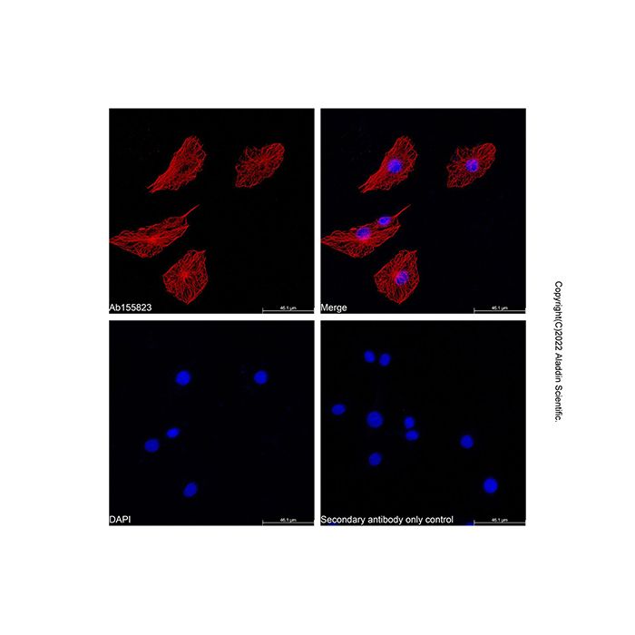 LumiDye™ AF555 NHS Ester - BioReagent,≥95%(HPLC) CAS No(A1507084) by Aladdin Scientific