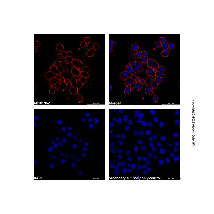 LumiDye™ AF594 NHS Ester - BioReagent CAS No(295348-87-7(free base)) by Aladdin Scientific