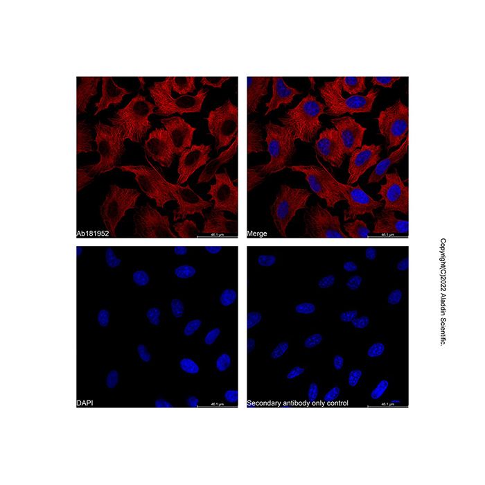 LumiDye™ AF647 NHS Ester - ≥95%(HPLC) CAS No(A1507087) by Aladdin Scientific