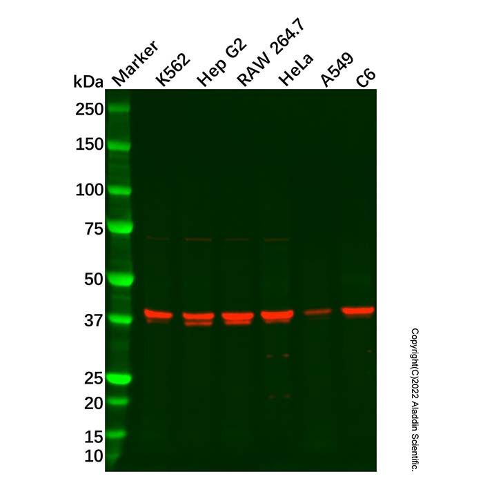 67kDa Laminin Receptor Antibody -    by Aladdin Scientific