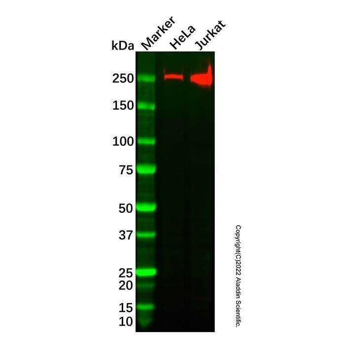Acetyl Coenzyme A Carboxylase Antibody -    by Aladdin Scientific