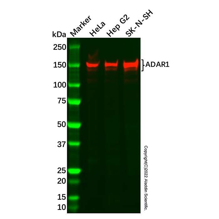 Recombinant ADAR1 Antibody -    by Aladdin Scientific