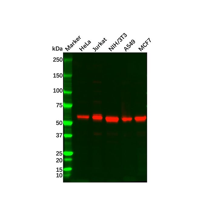 Recombinant AKT1/AKT2/AKT3 Antibody -    by Aladdin Scientific