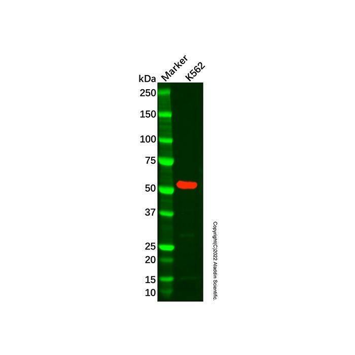 Recombinant ALDH1A2 Antibody -    by Aladdin Scientific