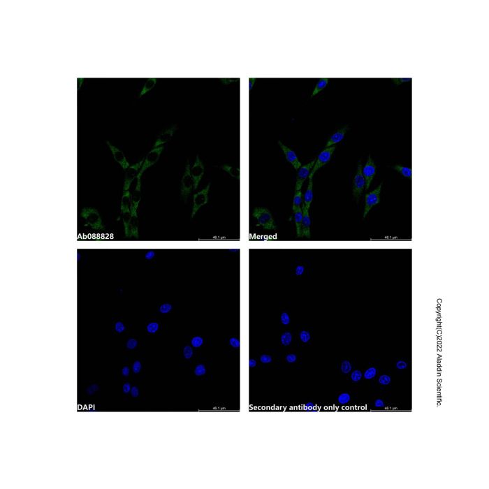 Recombinant Angiotensin Converting Enzyme 1 Antibody -    by Aladdin Scientific