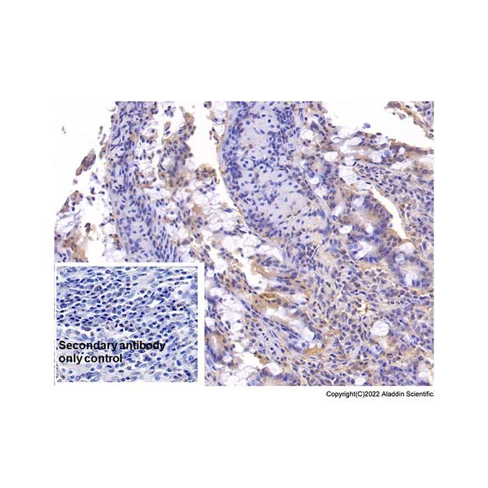 Annexin V/ANXA5 Mouse mAb -    by Aladdin Scientific