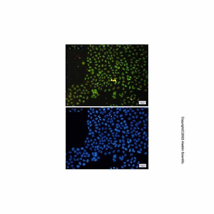 Recombinant ASH2L Antibody -    by Aladdin Scientific