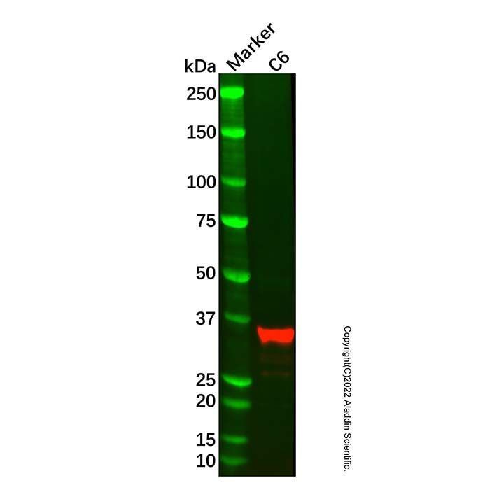 Recombinant ASPA Antibody -    by Aladdin Scientific