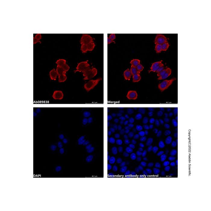 Recombinant Asparagine synthetase Antibody -    by Aladdin Scientific
