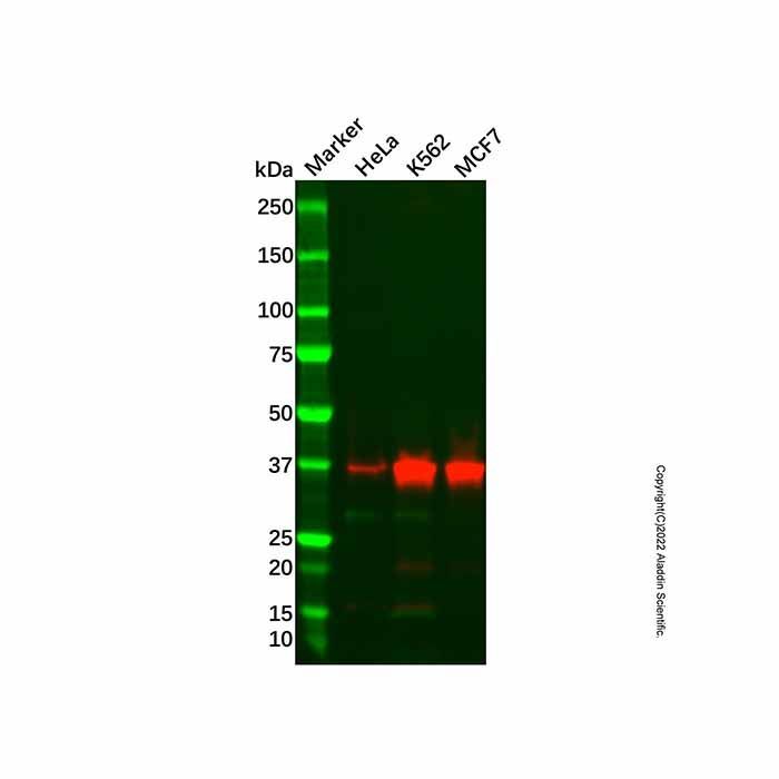 Recombinant ATP6V0D1/P39 Antibody -    by Aladdin Scientific