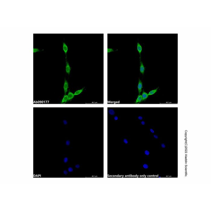 ATP6V1D Antibody -    by Aladdin Scientific