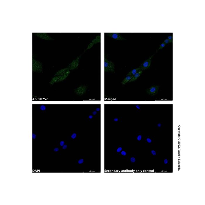 Recombinant Bcl10 Antibody -    by Aladdin Scientific