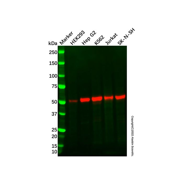 Recombinant beta Arrestin 1 Antibody -    by Aladdin Scientific