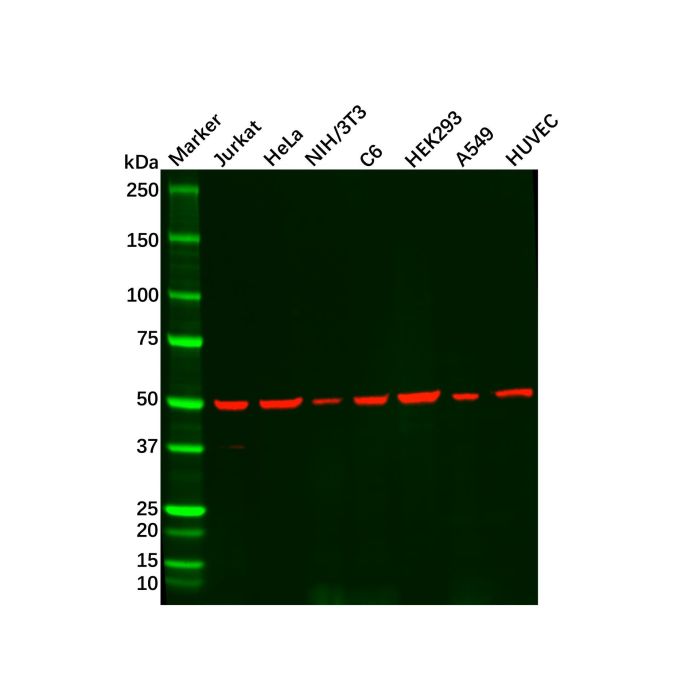 Recombinant beta III Tubulin Antibody -    by Aladdin Scientific