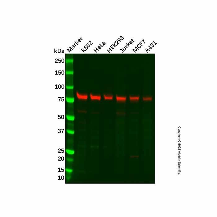Recombinant BRAT1 Antibody -    by Aladdin Scientific