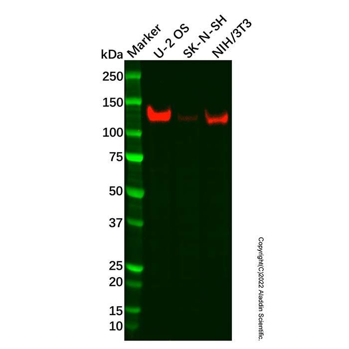 Recombinant cadherin 10 Antibody -    by Aladdin Scientific