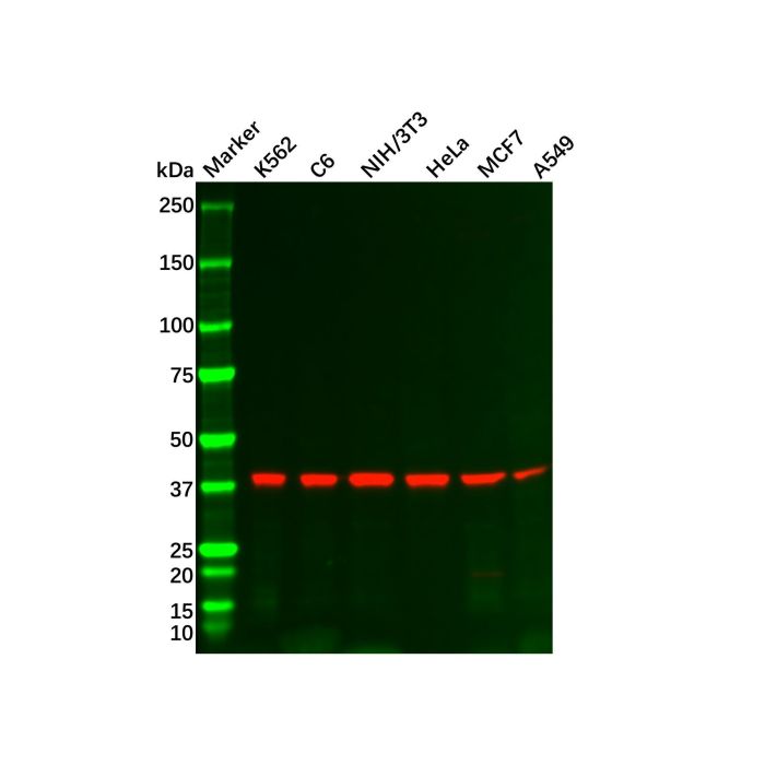 Recombinant PRKACA Antibody -    by Aladdin Scientific