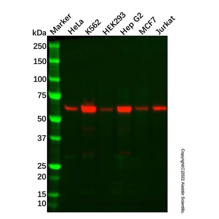 Recombinant Catalase Antibody -    by Aladdin Scientific