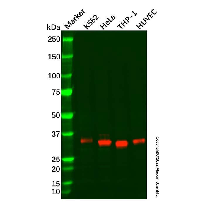 Recombinant Cathepsin Z Antibody - by Aladdin Scientific