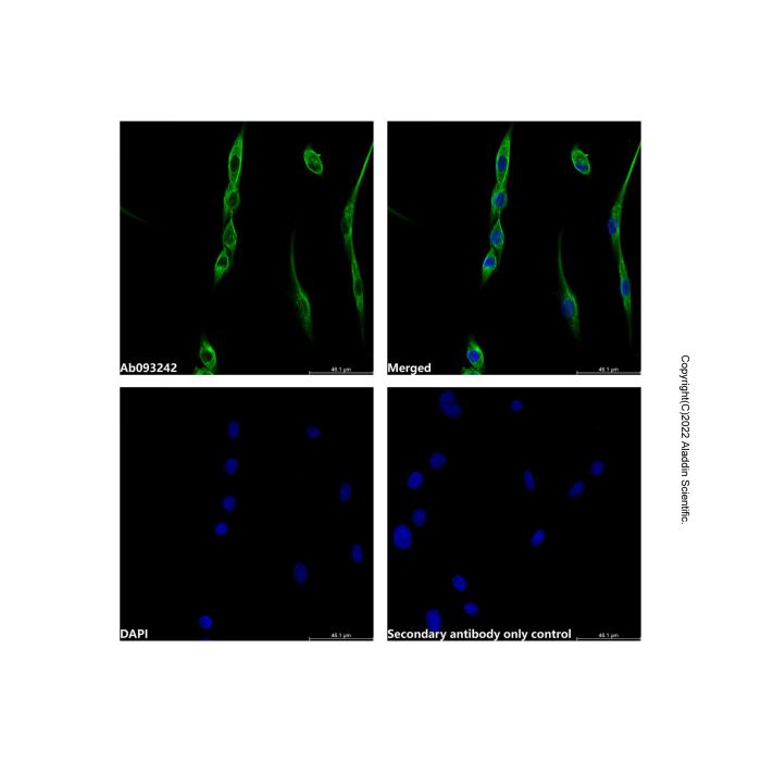 Caveolin-1 Antibody -    by Aladdin Scientific