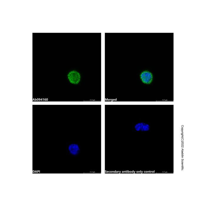 Recombinant CD2 Antibody -    by Aladdin Scientific