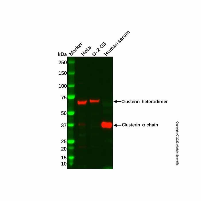 Recombinant Clusterin Antibody -    by Aladdin Scientific