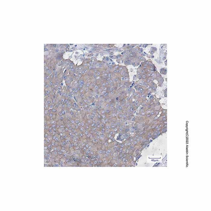 Recombinant Cortactin Antibody -    by Aladdin Scientific