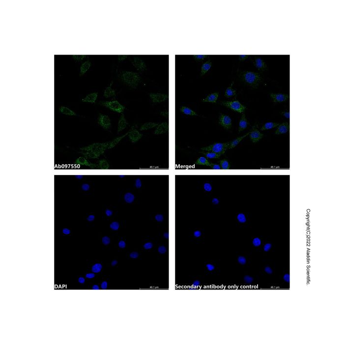 Recombinant CPS1 Antibody -    by Aladdin Scientific