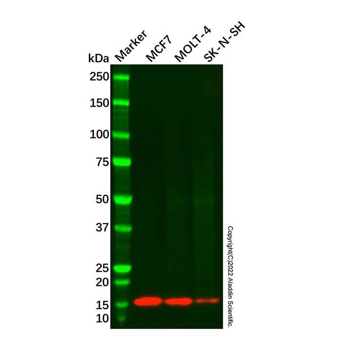 Recombinant CRABP1 Antibody -    by Aladdin Scientific