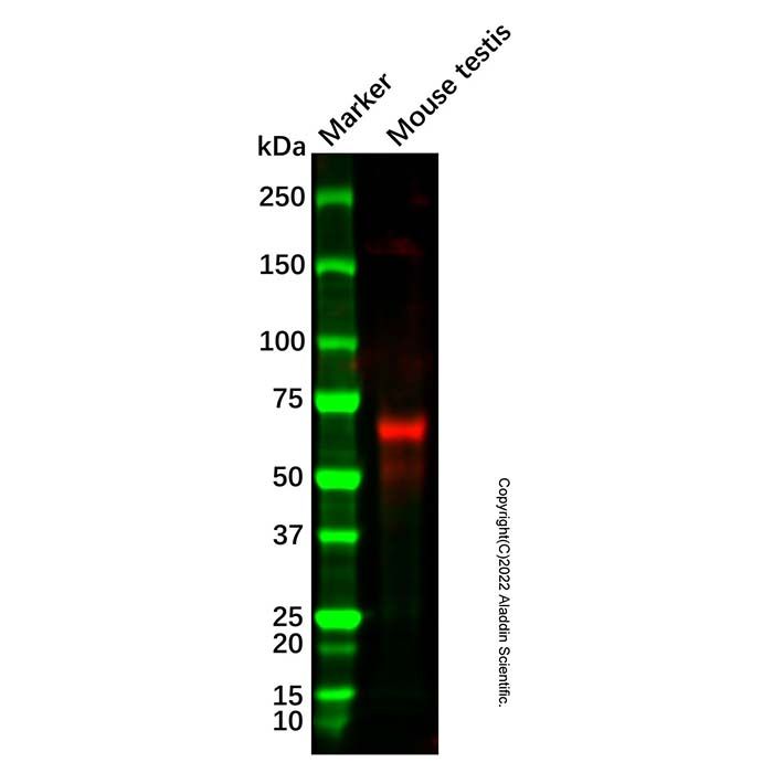 CRY2 Mouse mAb -    by Aladdin Scientific