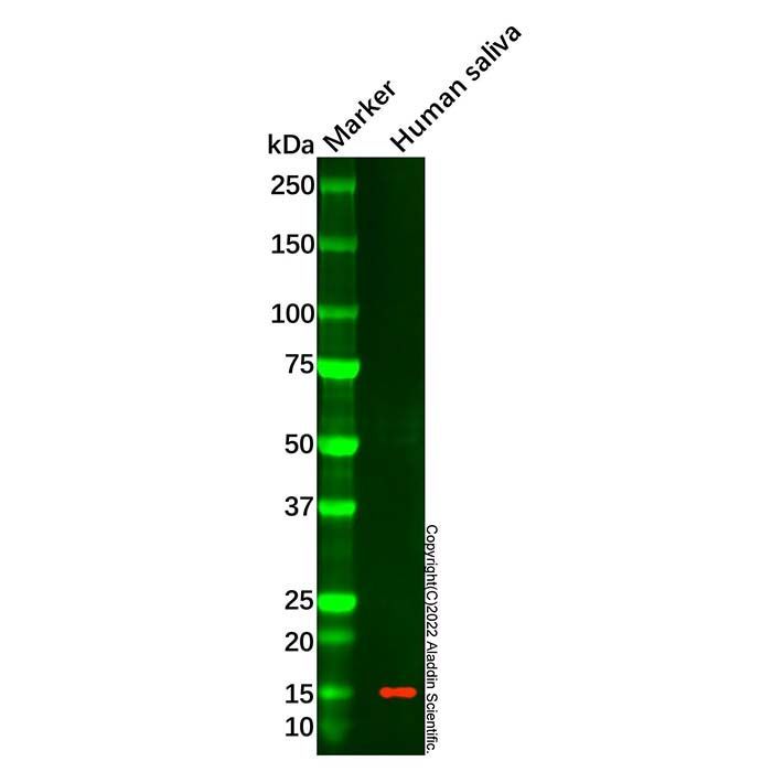 Cystatin S Mouse mAb - by Aladdin Scientific