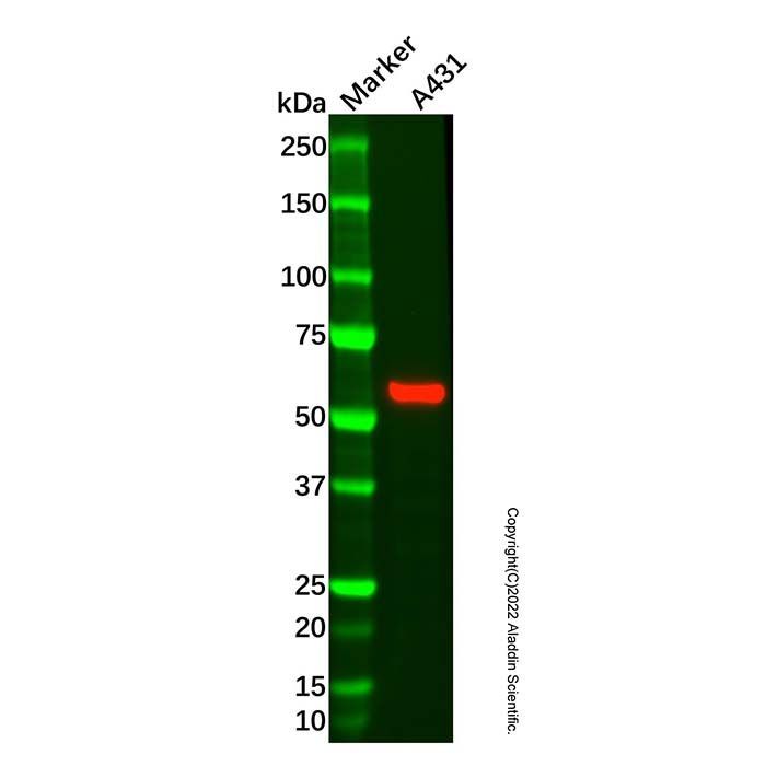 Recombinant Cytokeratin 4 Antibody -    by Aladdin Scientific