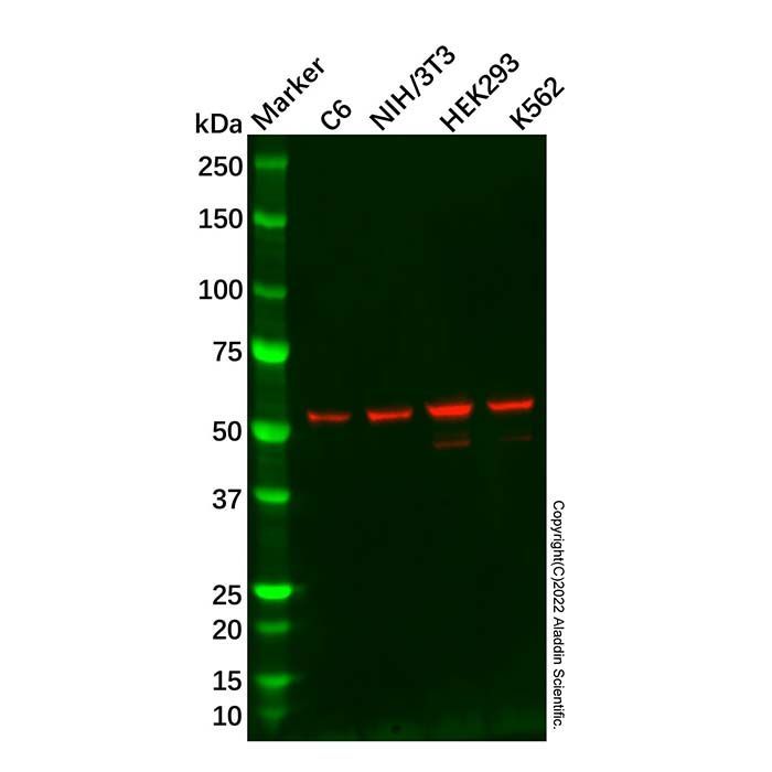 Recombinant DDX6 Antibody -    by Aladdin Scientific
