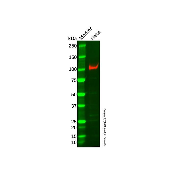 Recombinant Desmocollin 3 Antibody -    by Aladdin Scientific