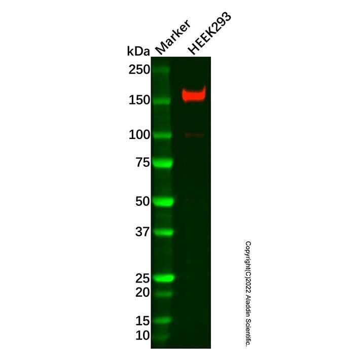 Recombinant DIAPH1 Antibody -    by Aladdin Scientific