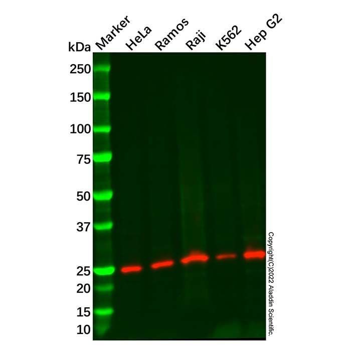 Recombinant DTYMK Antibody -    by Aladdin Scientific