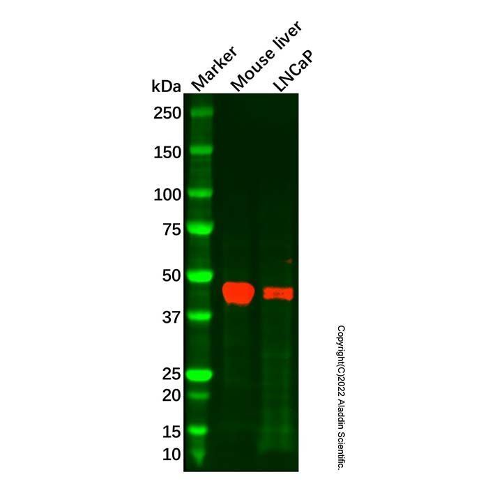 Recombinant ENTPD5 Antibody -    by Aladdin Scientific