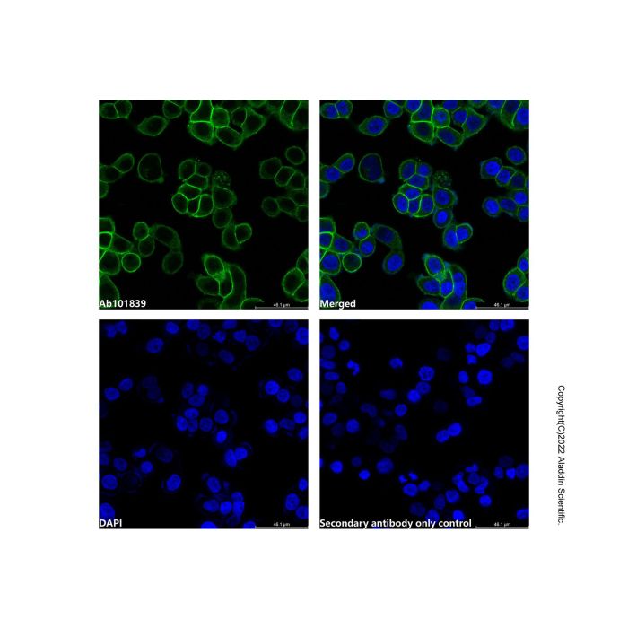 Recombinant EpCAM Antibody - by Aladdin Scientific