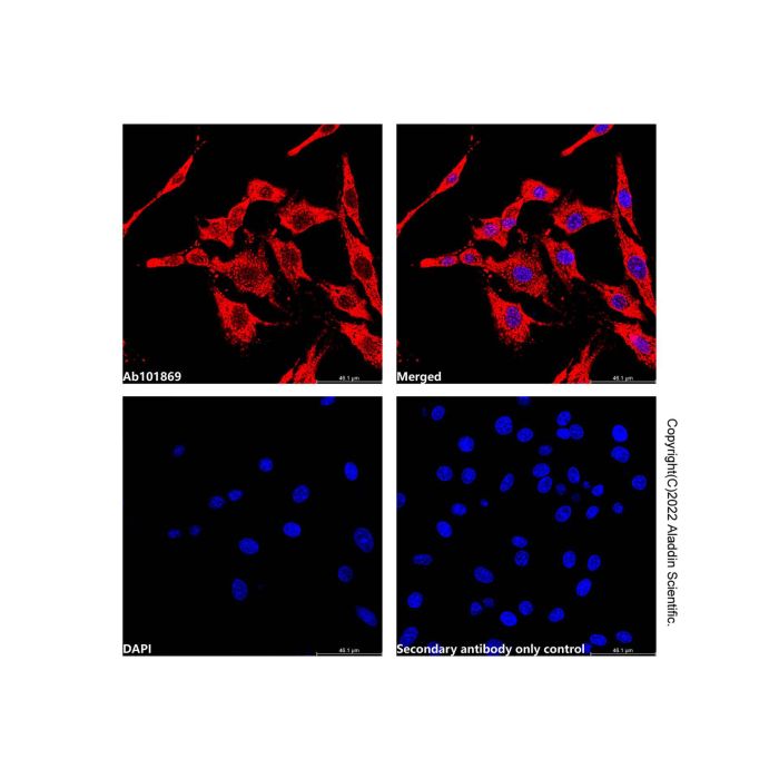 Recombinant EPF Antibody -    by Aladdin Scientific