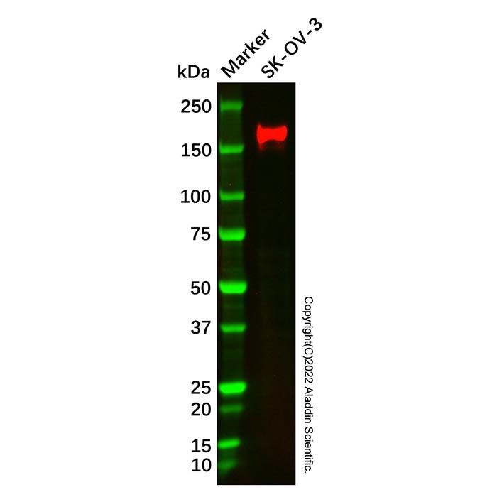 ErbB2/Her2 Mouse mAb -    by Aladdin Scientific